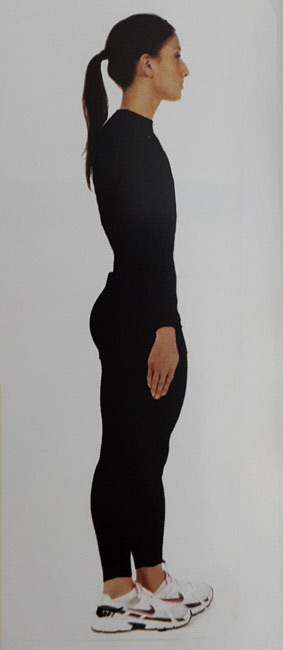 کشش نوارخاصره ای &ndash; درشت نئی ( ایلیوتیبیال باند )