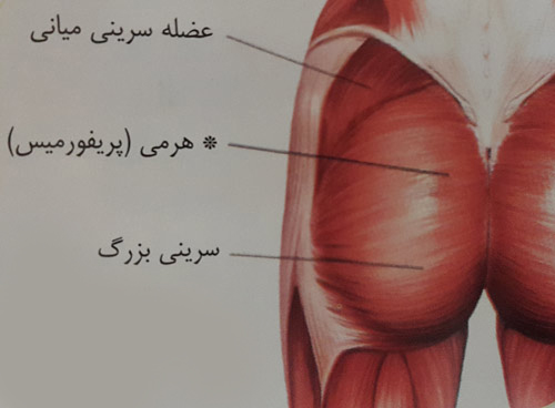 کشش عضله هرمی ( پریفورمیس ) 